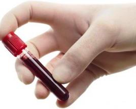 Пониженный уровень тромбоцитов в крови Тромбоциты 120 у женщин что значит